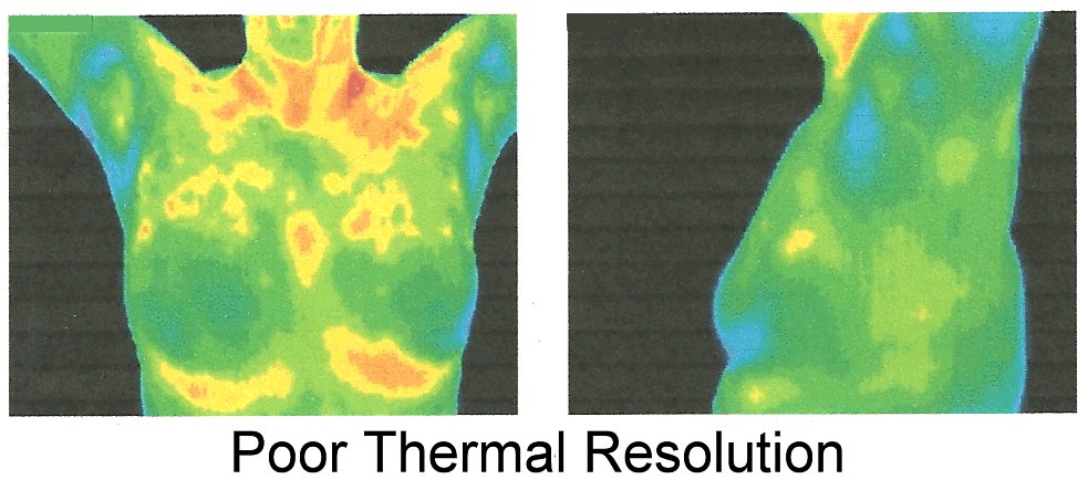 Example of poor thermal resolution.